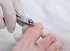 ОРТОНИКСИЯ: Методика коррекции вросшего ногтя - «Титановая нить» и онихолизис. 